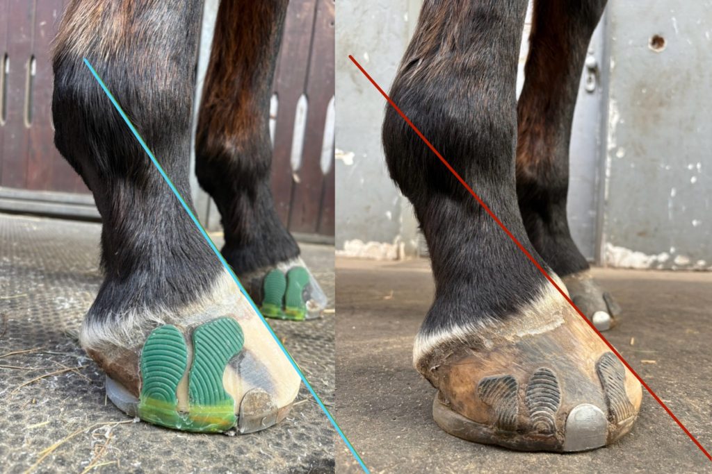 negativer Palmarer Hufbeinwinkel, Klebebeschlag